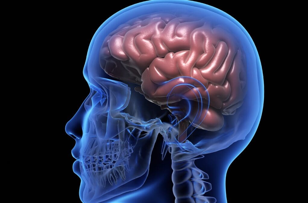 cocaine overdose symptoms showing an image of a brain