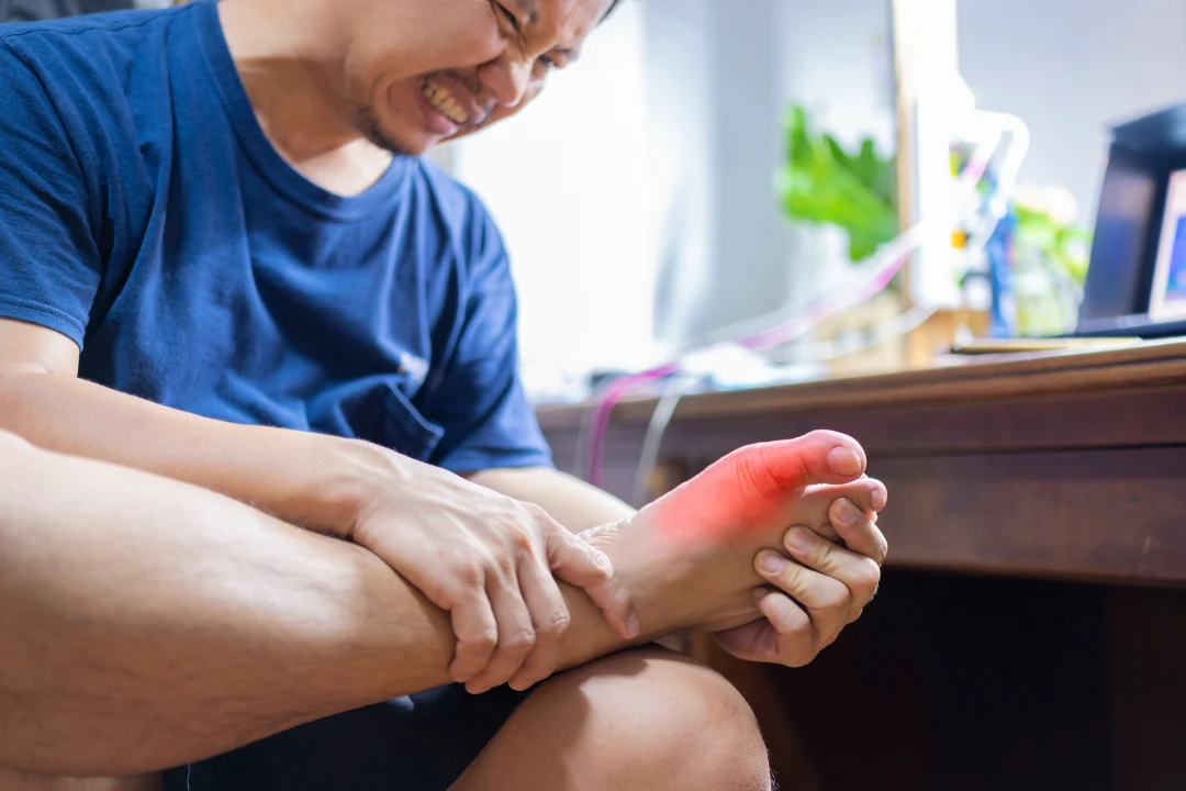 A man suffering from severe pain with gout inflaming.