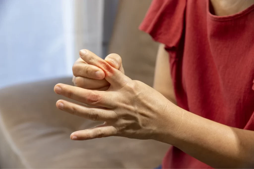 A young boy suffering from gout in his fingers. 